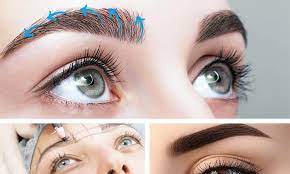 How is Eyebrow Transplantation Performed?