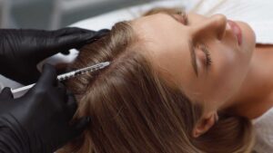 What is hair mesotherapy?